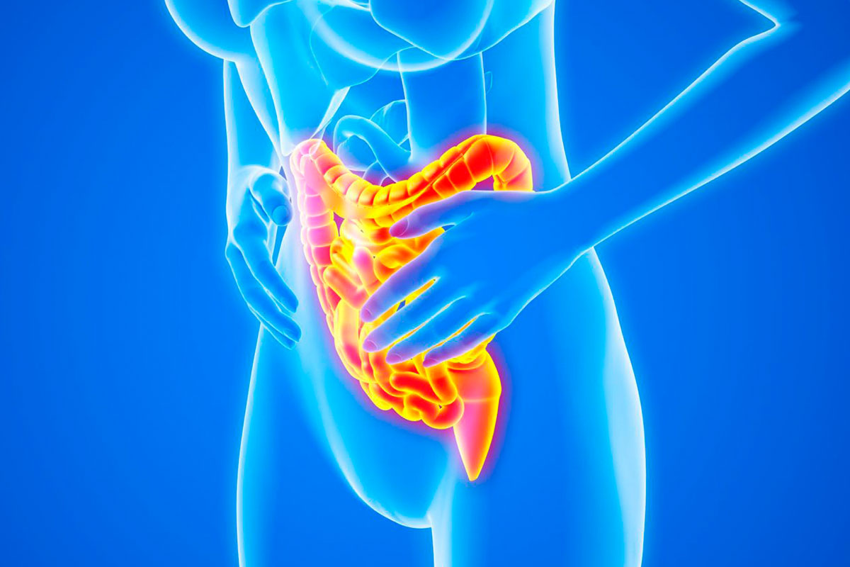 SIBO (Small Intestinal Bacterial Overgrowth)