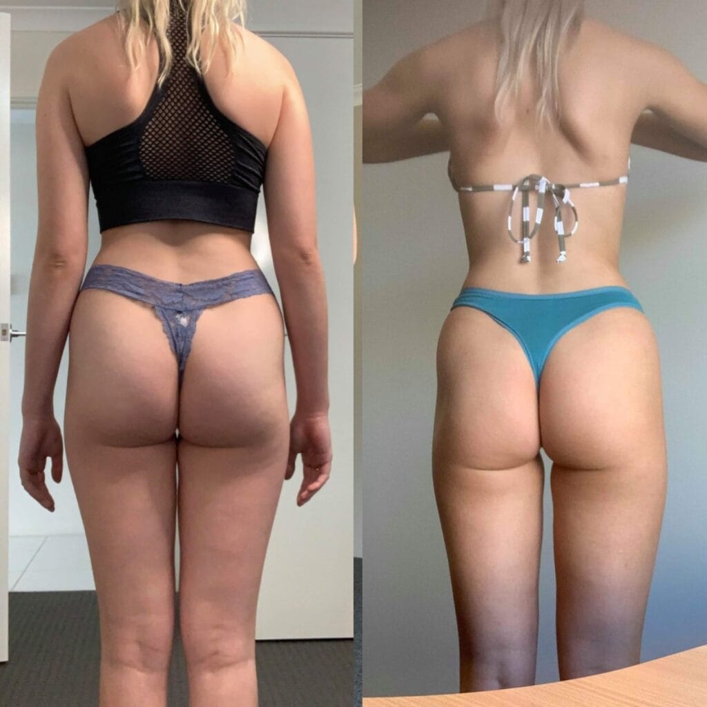 before and after - 22